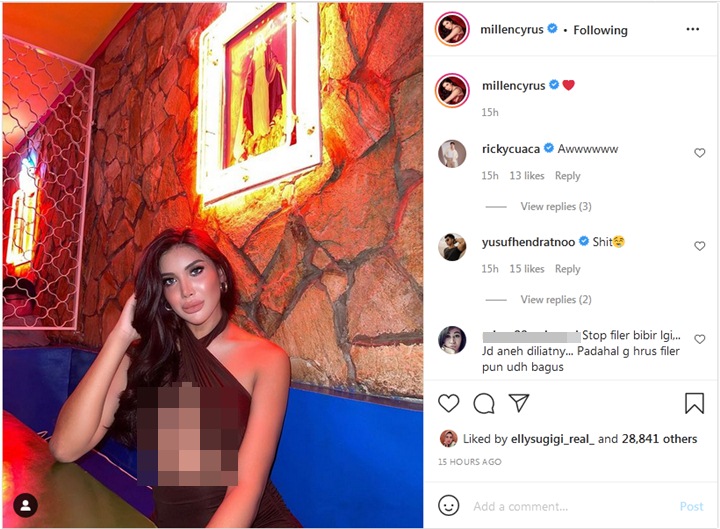 Millendaru Pajang Foto Seksi Bentuk Bibir Justru Jadi Sorotan Disebut Aneh