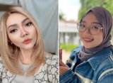Rina Nose Tinggalkan Komentar Tak Biasa di Foto Putri Ridwan Kamil Lepas Hijab