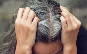 Rambut Memutih Bikin Kurang Pede Tenang Aja 7 Makanan Ini Bisa Bantu Cegah Uban Di Usia