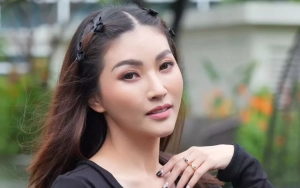 Sarwendah Tampil Percaya Diri Bagikan Video Transisi Before-After Makeup dengan Wajah Lebam