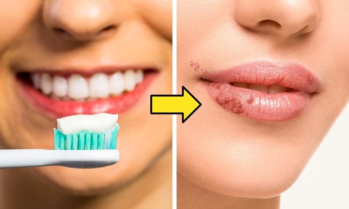 Gunakan Sikat Gigi untuk Mengatasi Bibir Gelap