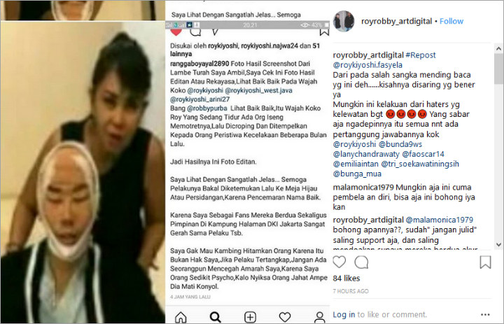 Beber Bukti, Fans Sebut Foto Roy Kiyoshi Pakai Perban di Wajah Hasil Editan