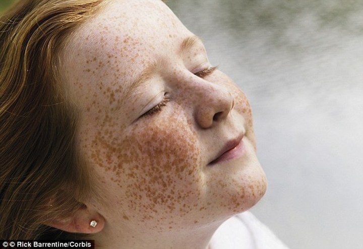 Freckles Mejadi Pengukur Sensitifitas Kulit Terhadap Matahari