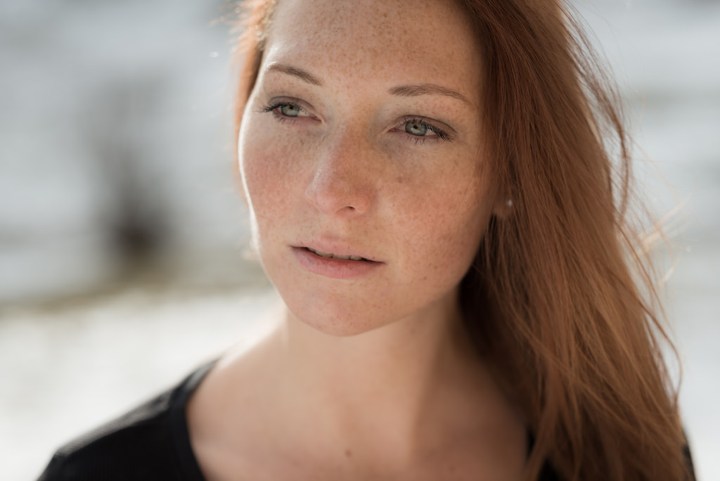 Freckles Berfungsi Sebagai Sunscreen Alami Kulit