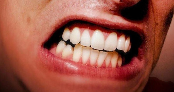 Bahaya Menggertakkan Gigi