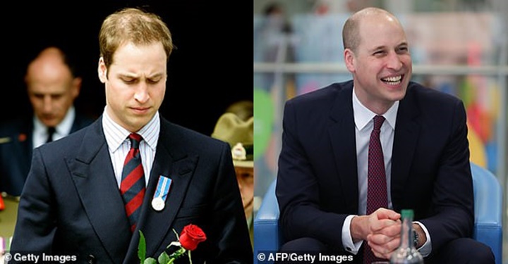 Aktor Ini Sebut Kepala Botak Pangeran William Membuatnya Trauma