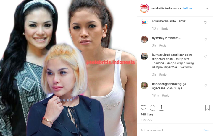 Foto Nikita Mirzani Sebelum Oplas Dipuji Manis, Ashanty Jelaskan