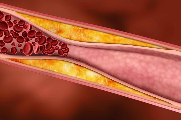Bengkuang Mampu Menurunkan Kadar Kolesterol Darah