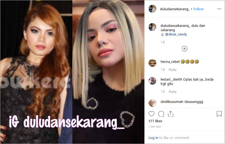 Beredar Foto Lawas Dinar Candy Yang Beda Banget Bentuk 