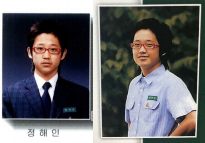 Jung Hae In Dicurigai Operasi Plastik 2