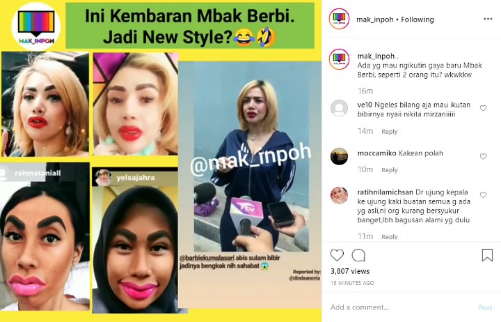 Hasil Sulam Bibir Barbie Kumalasari Ditirukan Banyak Netizen, Jadi New Style?