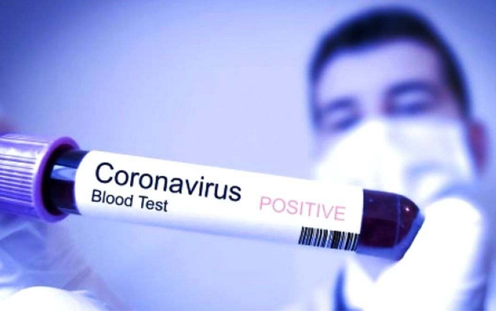 Orang-Orang Ini Memiliki Kemungkinan Lebih Besar Tertular Virus Corona