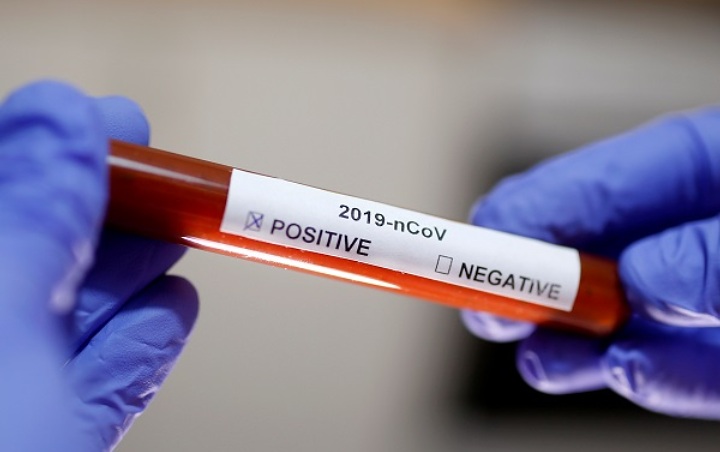 Tiongkok Patenkan Antivirus Ebola Milik AS Untuk Penanganan Corona, Tanda Vaksin Ditemukan?
