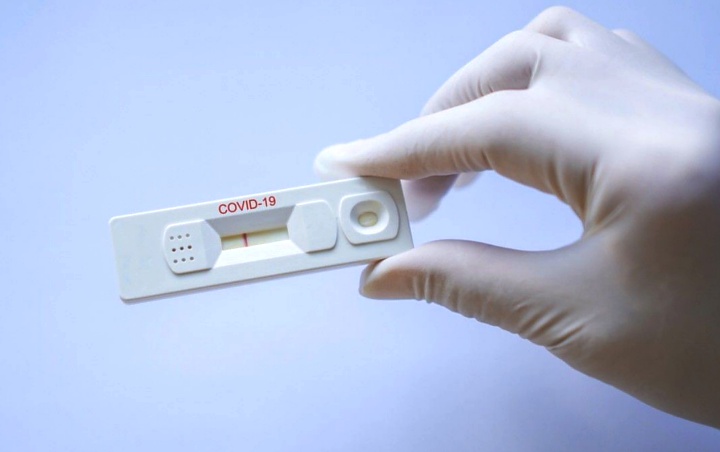 Ini Kata Pakar Soal Pengadaan Rapid Test Massal Virus Corona
