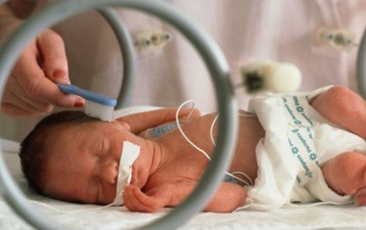 Apa Virus Corona Menyebabkan Bayi Lahir Prematur?