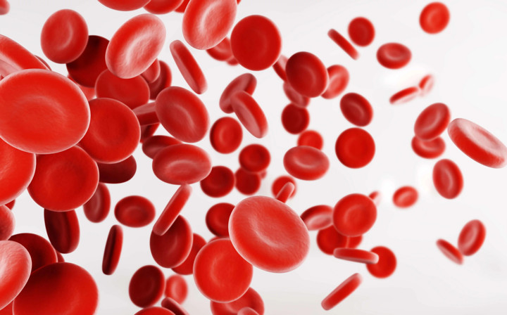 Hemolytic Anemia Salah Satu Penyakit Autoimun Yang Menyerang Darah