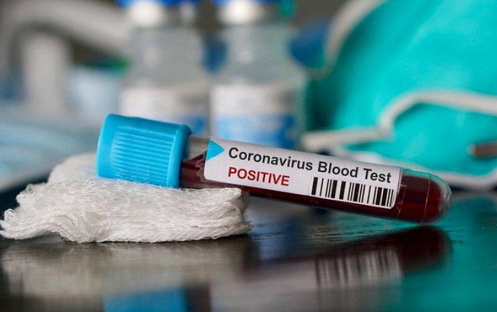 Kasus Corona Dunia Lampaui 5 Juta, Ilmuwan AS: Jangan Andalkan Vaksin