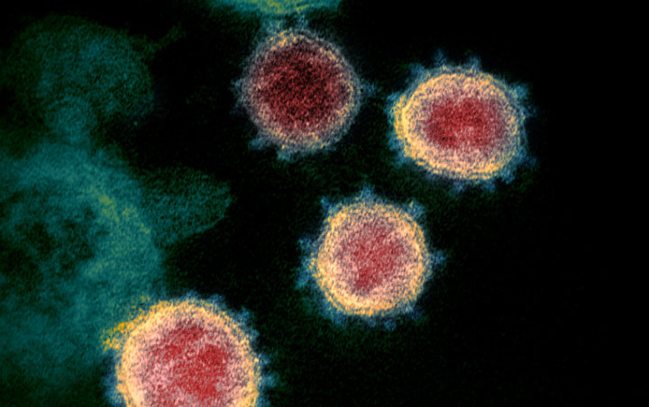 CDC AS Tambahkan 3 Gejala Terinfeksi Virus Corona, Ini Daftar Lengkapnya