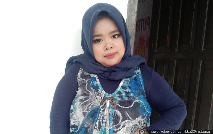 Rahmawati Kekeyi Nyengir Comeback di Instagram, Noda Merah di Gigi Jadi Tertawaan