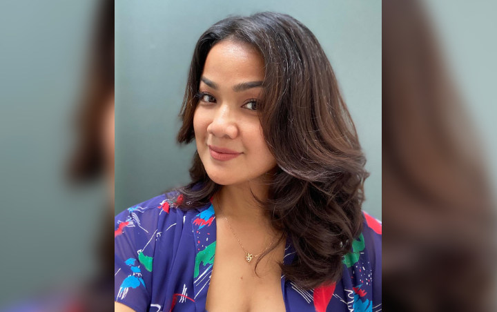 Nirina Zubir Unggah Foto Kaki Terluka dan Penuh Memar, Kenapa?