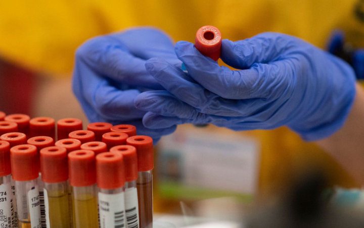 Vaksin Merah Putih Baru Akan Diproduksi Tahun 2022, Bagaimana Pengembangannya Saat Ini?