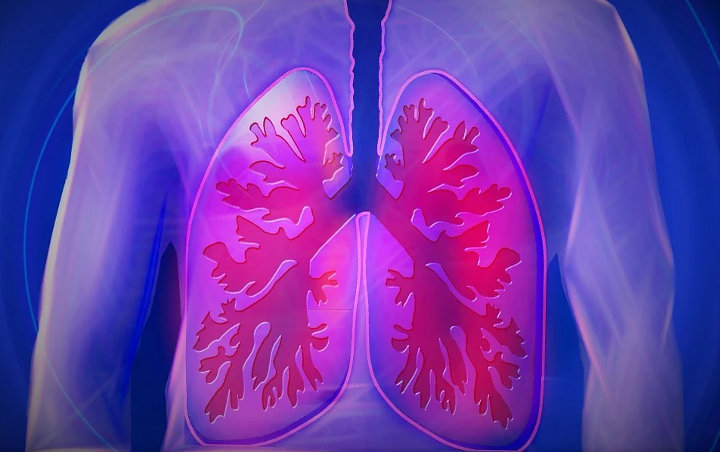 Kabar Baik! Kerusakan Paru-paru dan Jantung Akibat COVID-19 Bisa Sembuh