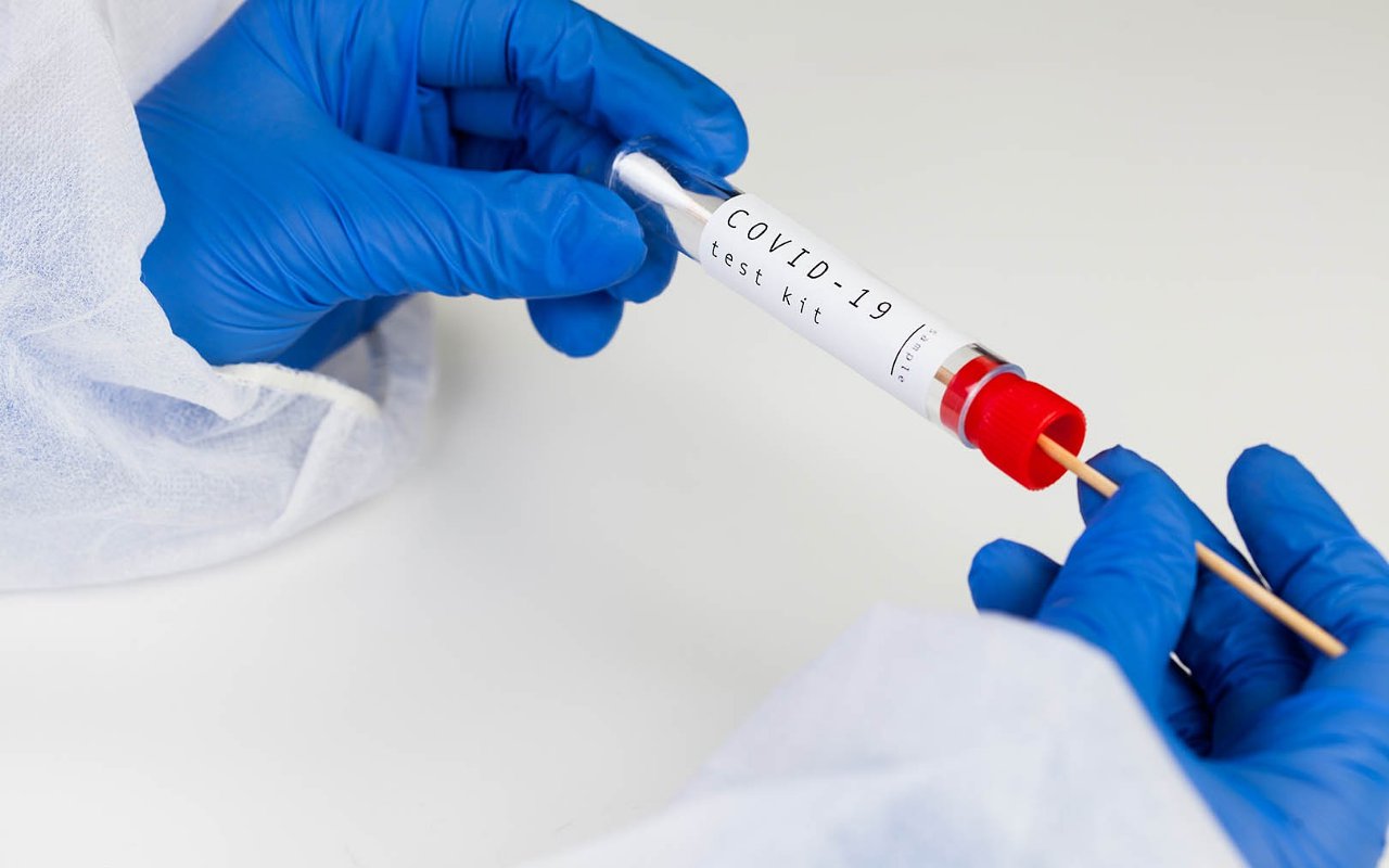 Dongkrak Tracing, Kemenkes Gunakan Rapid Test Antigen Untuk Diagnosis Kasus COVID-19